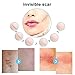 Scar Removal Cream,Scar Cream,Scar Treatment,Skin Repair Cream,Treatment for FaceBody Scar,Acne Spots,Stretch Mark Cream, Old and New Scars and Surgical Scars,For Men & Women 50ml