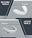 Densure Rx Mouth Guards- Pack Of 2- Professional Dental Guards- Clinically Tested- Relief From Bruxism, TMJ, Teeth Grinding-Adjustable size-Protection...for Atheletes