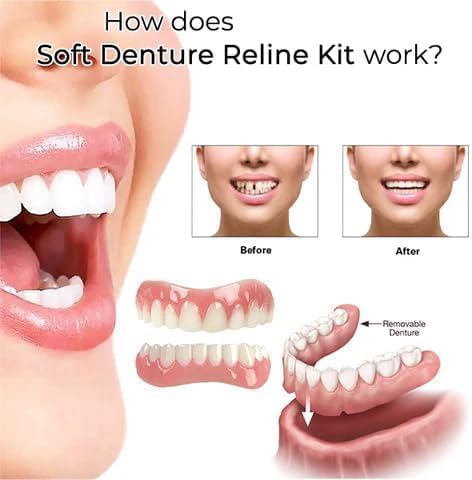 2PCS DENTURE SILICONE RELINE KIT, GREATFIT DENTURE SILICONE RELINE KIT, SOFT DENTURE RELINE KIT, SOFT DENTURE RELINE KIT FOR MEN AND WOMEN
