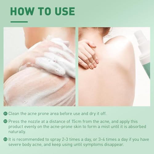 LBOYLOVE® Back Acne Treatment Spray – 2% Salicylic Acid & Hypochlorous Acid Spray for Body Acne, 120ml – Deep Cleansing, Fades Scars, Soothing Repair for Back, Chest & Shoulders
