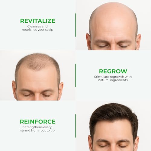 Green Wealth Neo Hair Lotion for Hair Loss Treatment | Hair Regrowth | Thinning, Bald Spots & Hair Fall | Trusted Formula with Ginseng, Saw Palmetto & Horsetail | 120ml