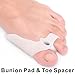 Skyfoot’s Bunion Relief, Toe Corrector and Separator Bunion Pad Kit for Correct Hallux Valgus - 8 Pieces