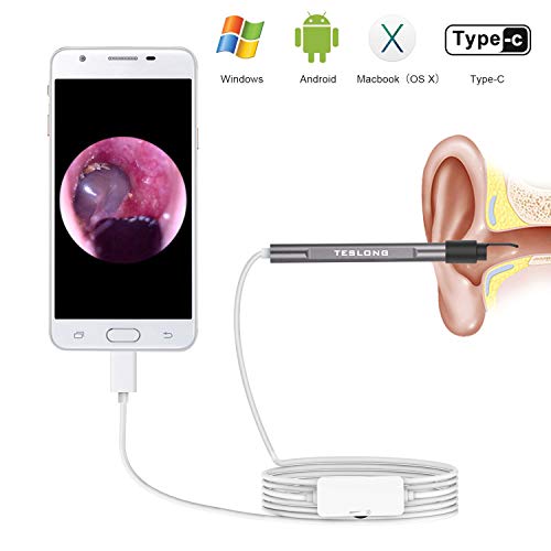 Teslong Digital Otoscope with Ear Wax Remover, HD Ear Otoscope Camera with 6 LED Lights for Android, Windows & MacBook Device