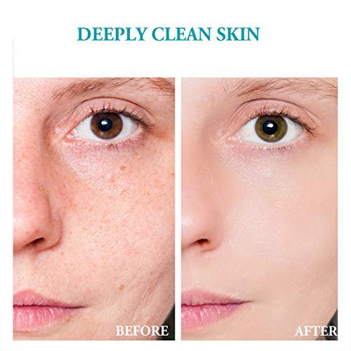 Salicylic Acid Deep Exfoliating Gel, Professionally Peel Cleanser, Rub Away Skin Aging Horniness and Dirt, Moisturize and Soften Skin, Reduce Wrinkles & Fine Lines