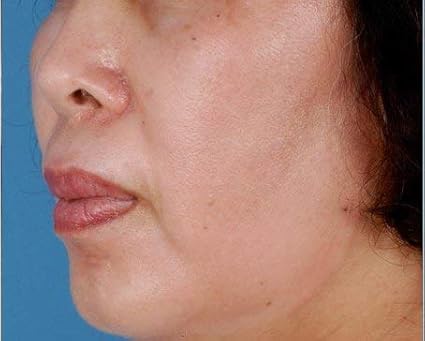 zo skin health retinol 0.5