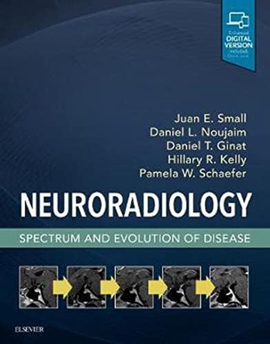 Osborn's Brain: 9780323477765: Medicine & Health Science Books