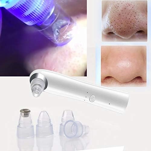 Eliminador de puntos negros, aspirador de puntos negros, limpiador ...