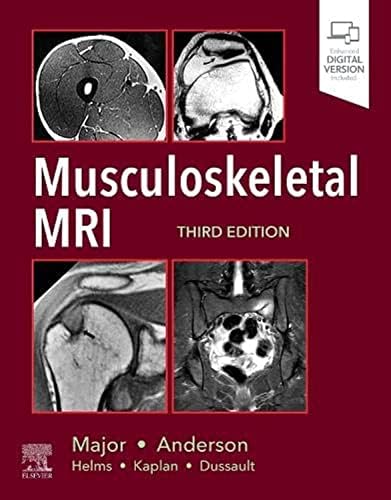 Diagnostic Imaging: Brain: 9781931884723: Medicine & Health
