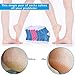 Heel Moisturizing Socks - Rendvieet Moisturizing Gel Heel Socks 2 Pairs Toeless Spa Socks for Heal, Treat Dry and Cracked Heels While You Sleeping (blue)