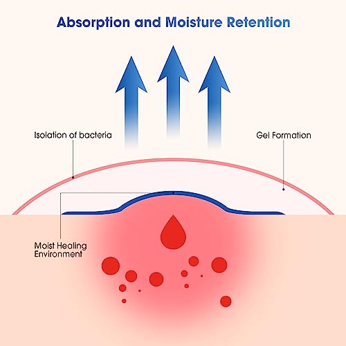 Ourmed Hydrocolloid Plasters Large 5 x 5 cm, 0.3 mm Thick, Waterproof Wound Plasters with Adhesive Surface for Light Exudate Wounds, Blisters, Acne, Surface Wound Care Pack of 10