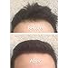 Nor1 Keratin Hair Building Fibers: Hair Fiber Filler and Thickener for Men and Women - Cover Up and Concealer for Thinning Areas or Minor Bald Spot - Thicker, Fuller Hair in Seconds - 25 grams, Grey