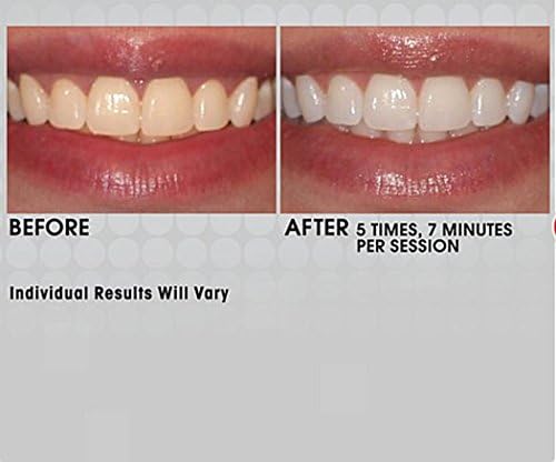 Intelliwhite Platinum Teeth Whitening System Double Up Kit ~ Mouthguard &amp; Gel &amp; 2 Pens!!!