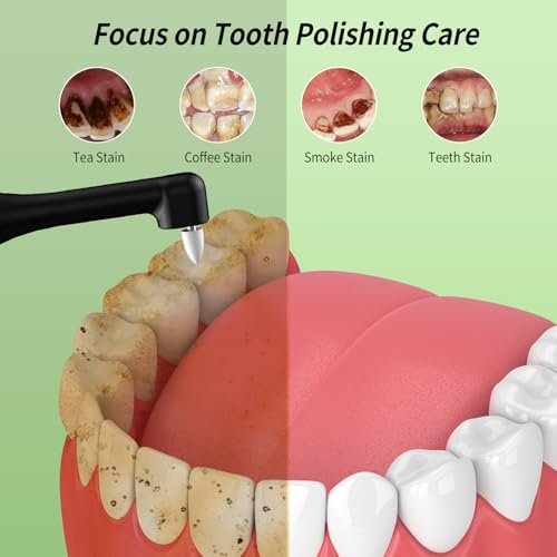 Tooth Polisher, Rechargeable Teeth Sander with 5 Brush Heads, 3 Polish Pastes, LED Light, 4 Speed Modes, Waterproof Dental Cleaning Kit for Whitening and Polishing (Black)
