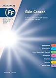 Fast Facts Skin Cancer : Fast Facts, Bunker, Christopher and Gilchrest, Barbara, 1903734630