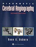 Diagnostic Cerebral Angiography by 