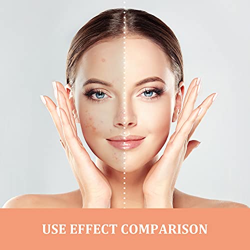 Pinkiou Air Cushions BB Cream CC Cream Mushroomhead Foundation Moisturizing Concealer Hyaluronic Acid Molecule Deep Moisturizing Brightens the Complexion and Lasts for a Ｌong Ｔime（Natural Color）