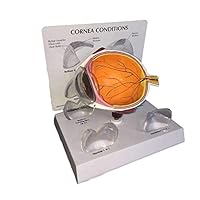 MKULOUS Human Eye Anatomy Model,Ophthalmology Teaching Model