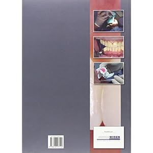 INTERVENCION BUCODENTAL (TECNICO SUP.HIGIENE BUCODENTAL)