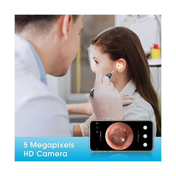 Ohr Otoskop VITCOCO 3.0mm WiFi Ohr Endoskop 5MP 1920P HD Ohr Endoskopkamera mit 6 LED Licht 2020 Neues Upgrade… – Bild 5