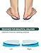 O/X Type Leg Shoe Inserts - Orthopedic Insole for Bowlegs and Knock Knees by ToeGlow