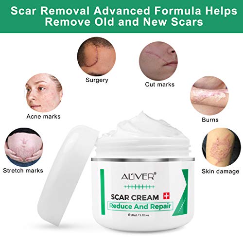 Scar Remover Cream, Reduce and Repair Skin, from CSection, Acne