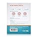PIMPLENDS Acne Pimple Patch Tea Tree & Mint Oil Pimple Sticker Pimple Dots Acne Cover Patch Acne Treatment Acne Stickers Absorbing Spot Dot | Drug-free Hydrocolloid Bandages 76 Patche