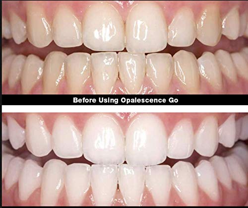 Opalescence Go 15 Teeth Whitening Trays Boxed 10 Pack Mint Flavor 