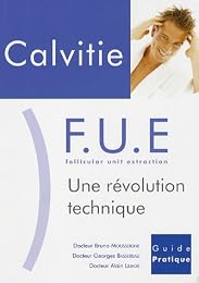 Calvitie