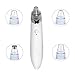 IREALIST Electronic Blackhead Extractor, USB Rechargeable Blackhead Removal Facial Pore Cleaner Acne Remover Tool (White)