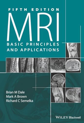 MRI: The Basics: 9781496384324: Medicine & Health Science Books