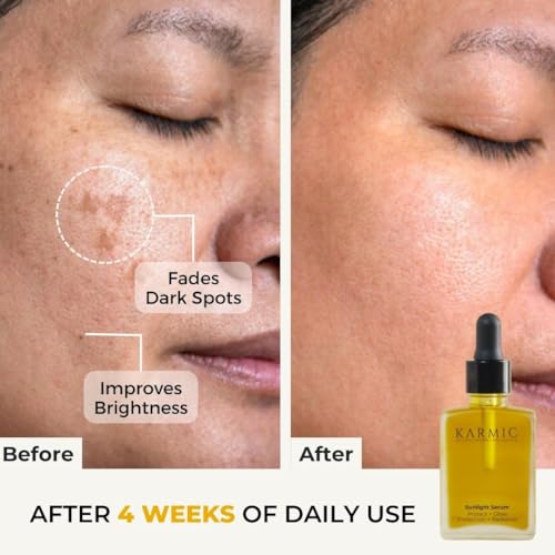 Karmic Skin Brightening Vitamin C Face Serum: With Saffron & Vit. E | Hydrate & Reveal Bright Glowing Skin | Correct Dark Spots | Treat Hyperpigmentation | Organic Facial Oil Skin Care | Women & Men