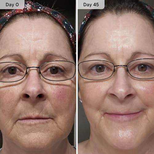 Qure Micro-Infusion System for Face - Blue Formula for All Skin Types, Easy 5min Skincare Facial Application - 3 Month Supply