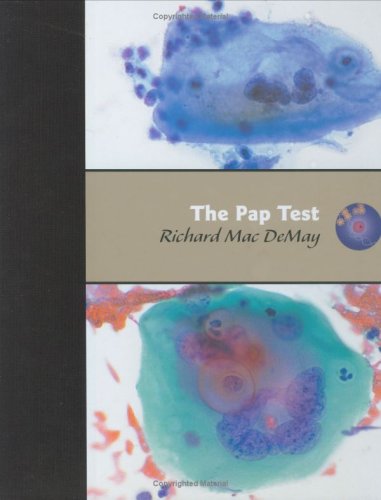 The Pap Test: Exfoliative Gynecologic Cytology