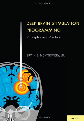 Deep Brain Stimulation Programming Principles and Practice (Hardcover)