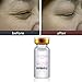 LtrottedJ 100% Natural Pure Firming Collagen， Strong Anti Wrinkle Hyaluronic Acid Serum New