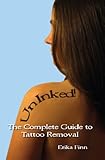 Tattoo Removal Cost