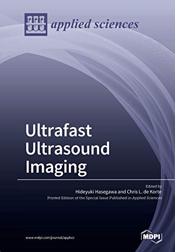 Ultrafast Ultrasound Imaging