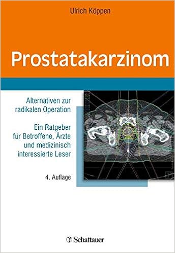 Prostatakarzinom Alternativen Zur Radikalen Operation Ein Ratgeber Fur Betroffene Arzte Und Medizinisch Interessierte Leser Amazon De Koppen Ulrich R Bucher