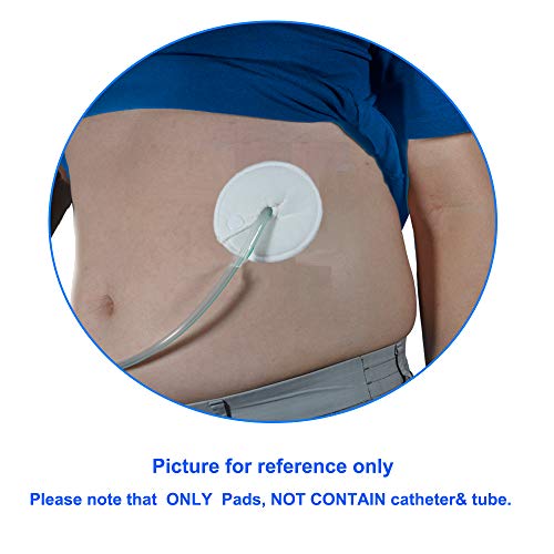 Gtube Pads Holder G Tube Button Pads Peritoneal Dialysis Feeding Tube
