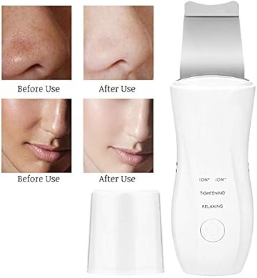 Duevin Purificador de piel ultrasónico Purificador facial ...