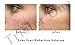 Tristar One Skin Care Titanium Microneedle 540 Micro Needles Derma Roller Needle-b4
