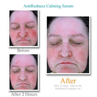 exuviance antiredness calming serum