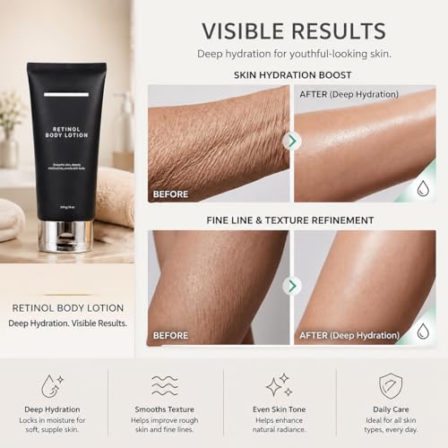 Retinol Body Lotion, Firming Body Cream for Crepey Skin, Moisturizing Anti-Aging Lotion for Neck, Arms, Legs & Full Body Skin Care, 170g