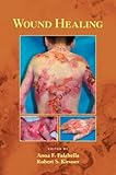 Wound Healing (Basic and Clinical Dermatology) by Anna Falabella, Robert Kirsner