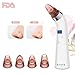 Blackhead Remover Facial Pore Vacuum Skin Acne Come-do Suction Electric Cleanser Extractor Removal Tool USB Rechargeable