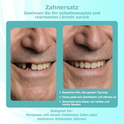 Custom Partial Dental Denture - Temporary Denture, Removable and Temporary Denture. Perfect fit and easy to use to recreate your smile at home (1 tooth)