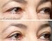 EasyLift The Original 60 Second Eye Lift | As Seen On TV | Lab Tested For Save Everyday Use | Made In the USA