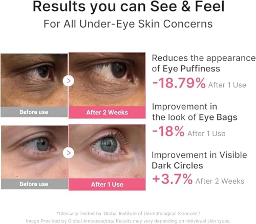 PDRN Caffeine Eye Patches for Dark Circles & Puffiness | Hydrating Under Eye Mask with Hyaluronic Acid & Niacinamide | Reduce Fine Lines & Brighten Tired Eyes - (60Patche) (Rose pink)