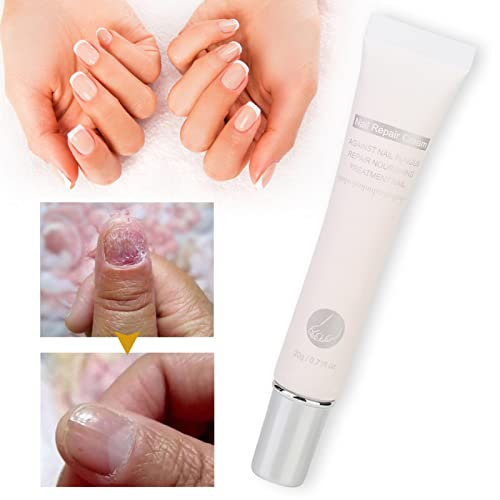 Nail Repair Cream, 20ML Nail Cream Repair, Nail Strengthener, Finger Toe Nail Care Cream for Men and Women Home Use