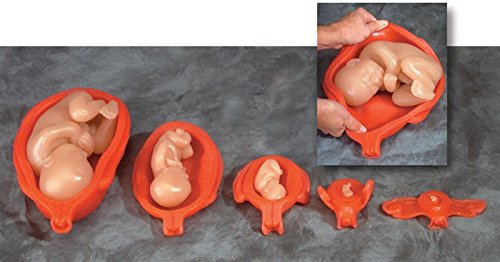 Uterus with Fetus Model Set